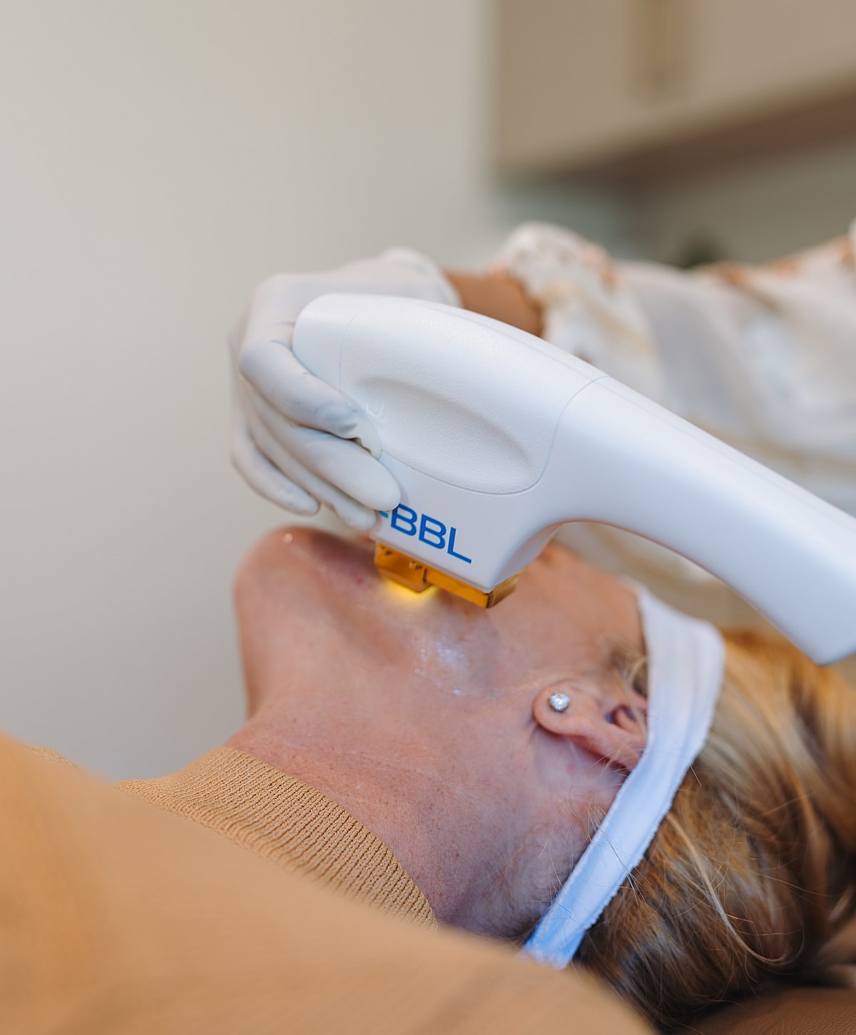 BBL treatment on a woman's neck area.