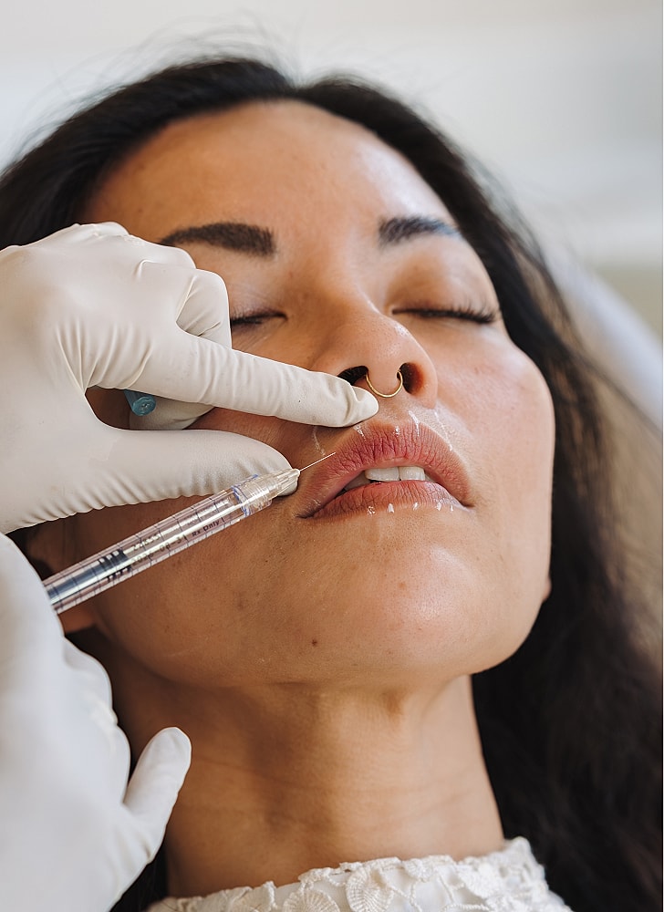 Cosmetic procedure involving lip enhancement injection.