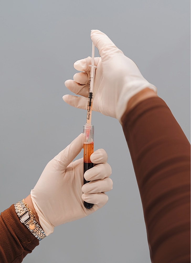 Laboratory hand holding blood-filled syringe.