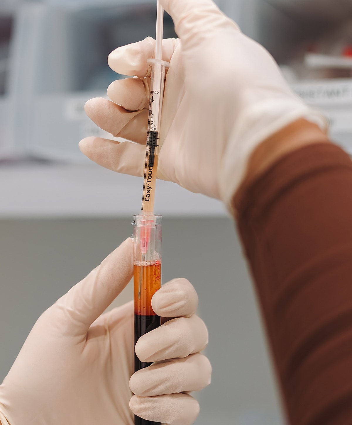 Blood sample collection with a syringe and tube.