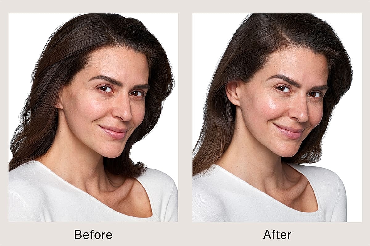 Skincare transformation before and after comparison.