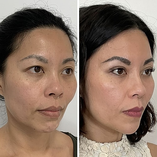 Before and after facial transformation comparison.