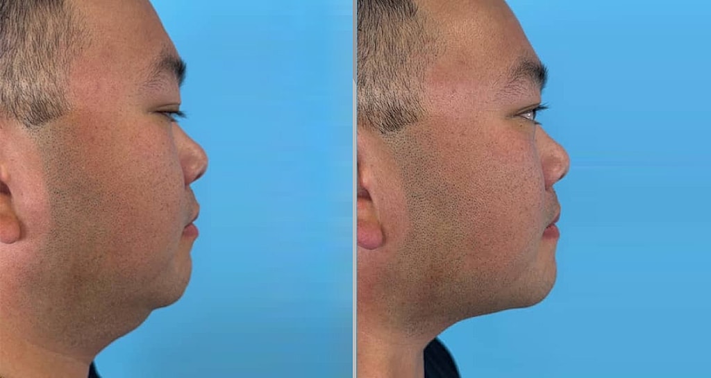 Profile comparison of a person on blue background
