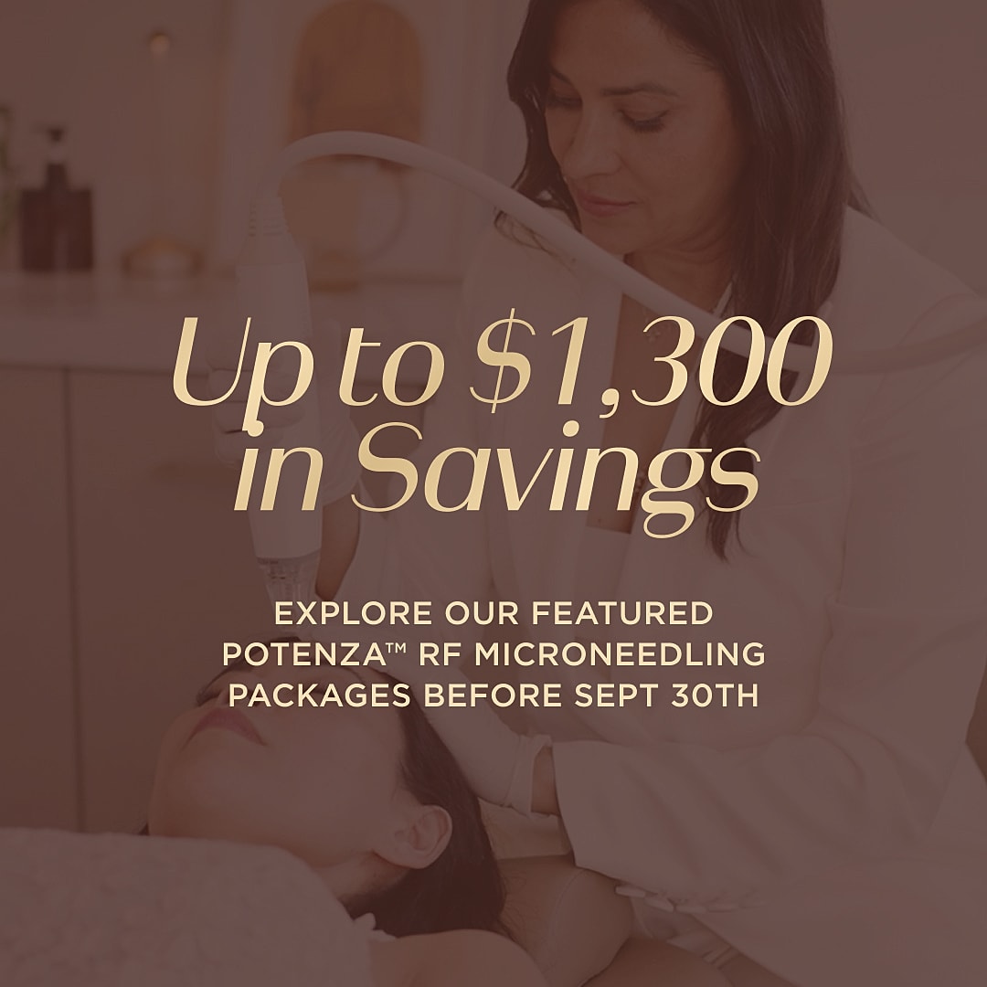 Potenza RF microneedling savings promotion announcement
