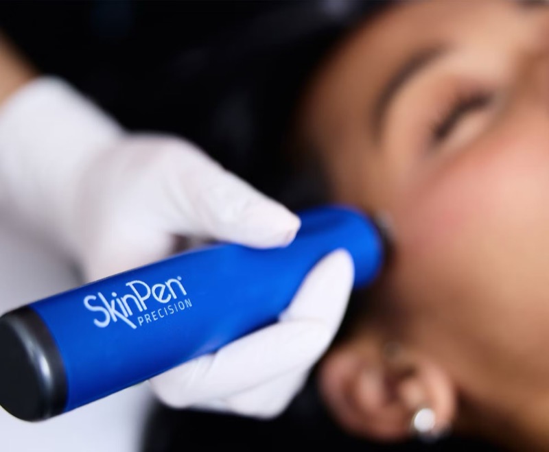 SkinPen Microneedling collagen induction therapy